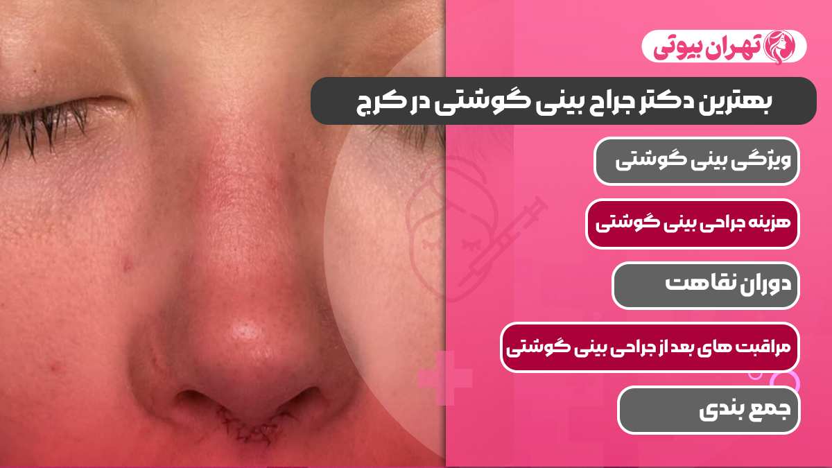 10 بهترین دکتر جراح بینی گوشتی در کرج