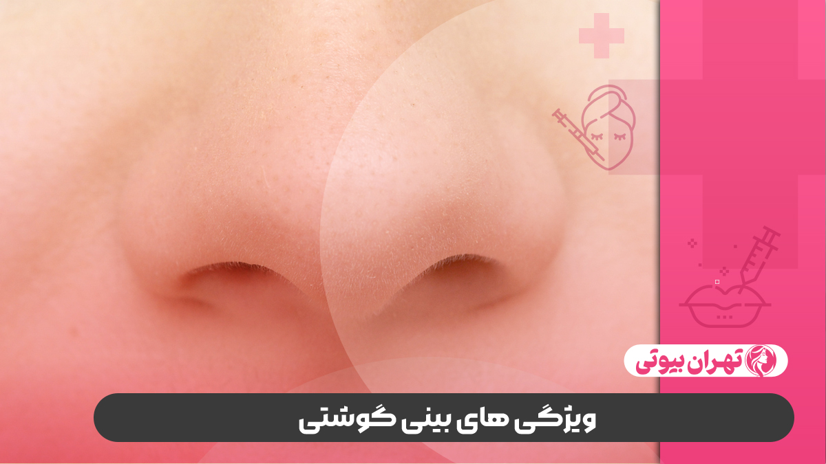 10 بهترین دکتر جراح بینی گوشتی در کرج