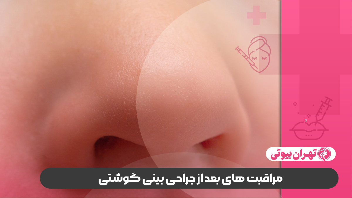10 بهترین دکتر جراح بینی گوشتی در کرج