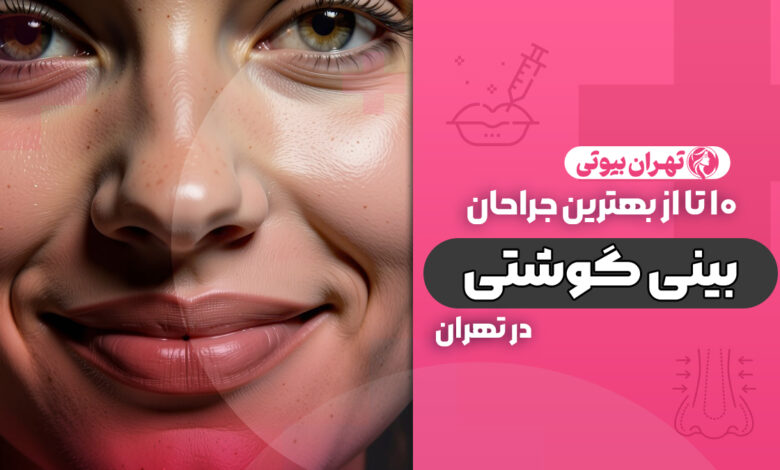 10 بهترین دکتر جراح بینی گوشتی در تهران