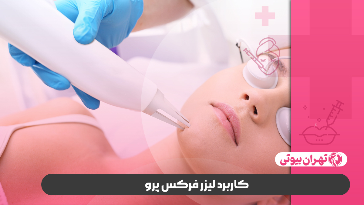 10 بهترین مرکز لیزر فرکس پرو در تهران