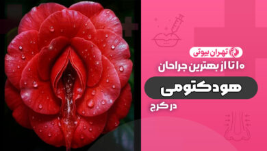 10 بهترین دکتر عمل هودکتومی در کرج