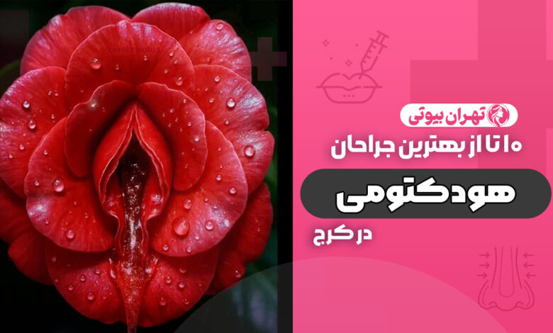 10 بهترین دکتر عمل هودکتومی در کرج