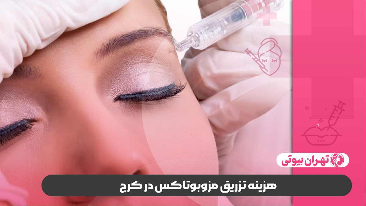 10 بهترین دکتر مزوبوتاکس در کرج