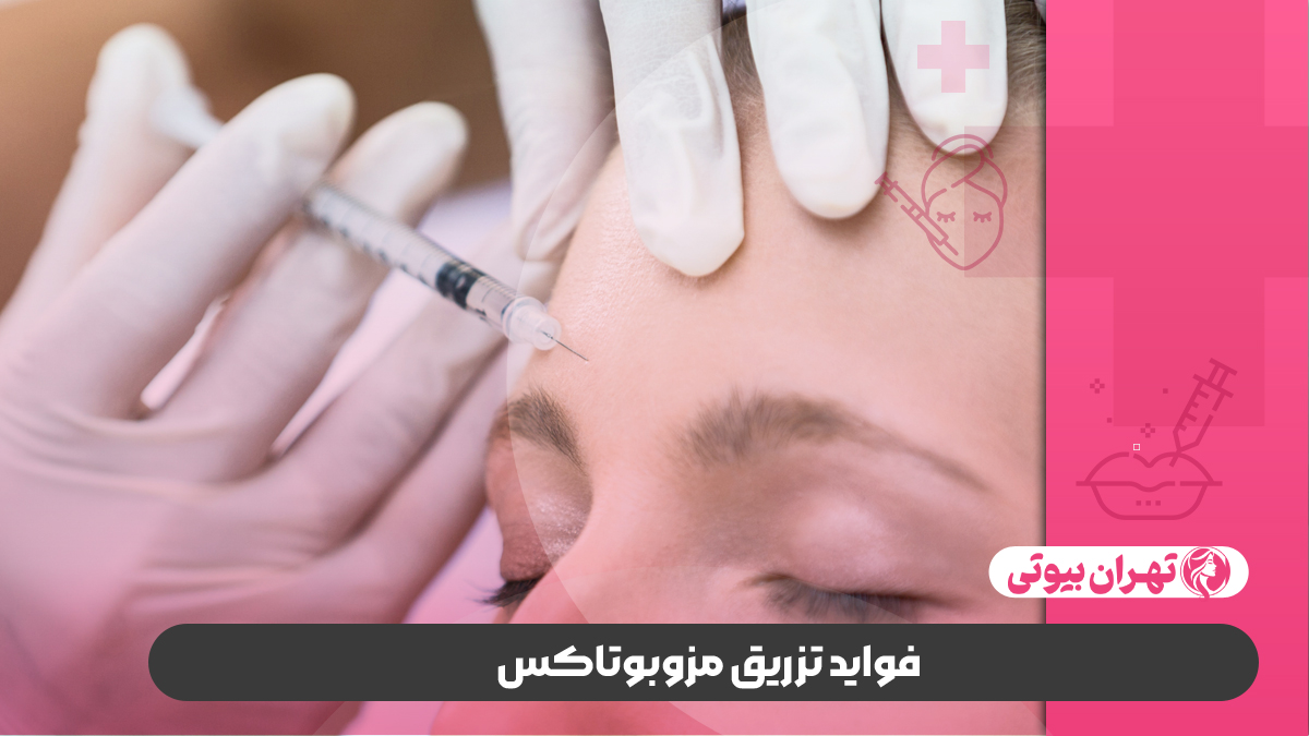 10 بهترین دکتر مزوبوتاکس در تهران