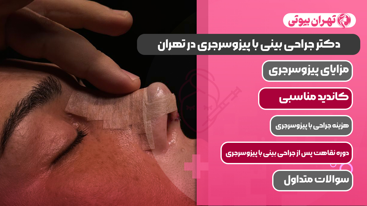 10 بهترین دکتر جراحی بینی با پیزوسرجری در تهران