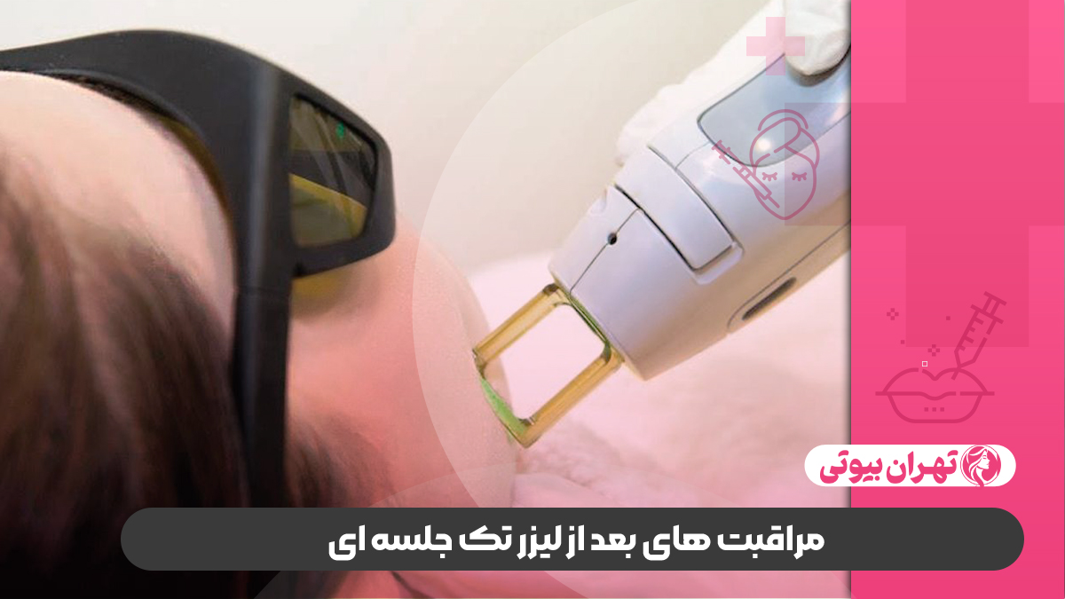 10 بهترین مرکز لیزر تک جلسه ای در کرج