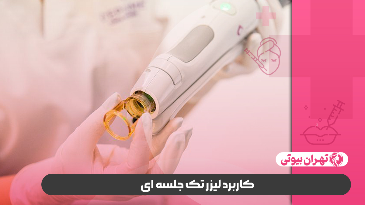 10 بهترین مرکز لیزر تک جلسه ای در کرج