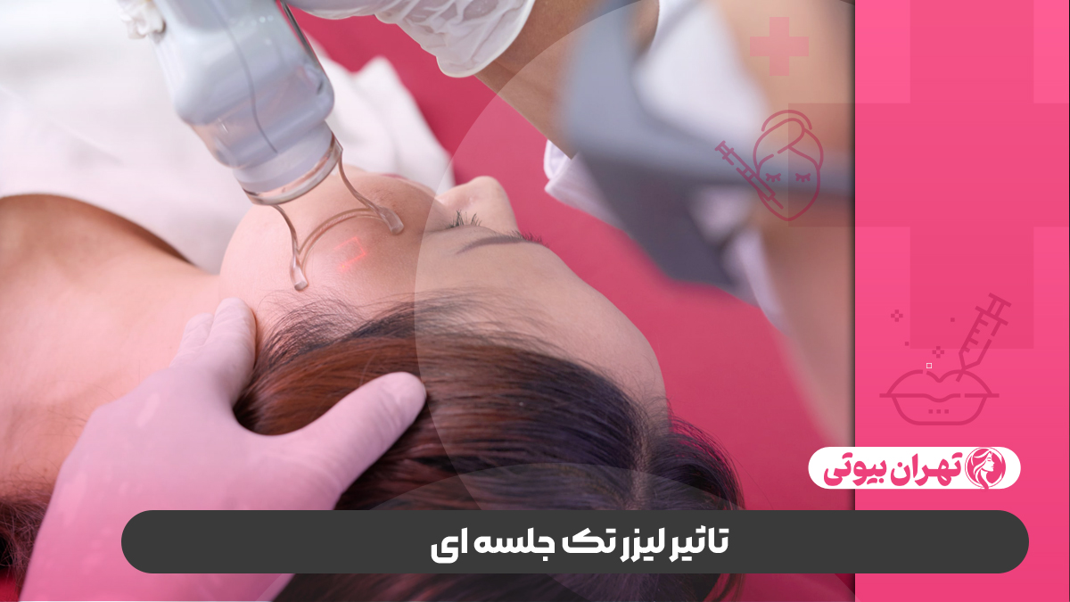 10 بهترین مرکز لیزر تک جلسه ای در تهران