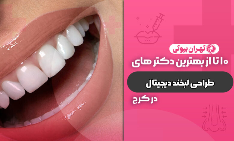 10 بهترین دکتر طراحی لبخند دیجیتال در کرج