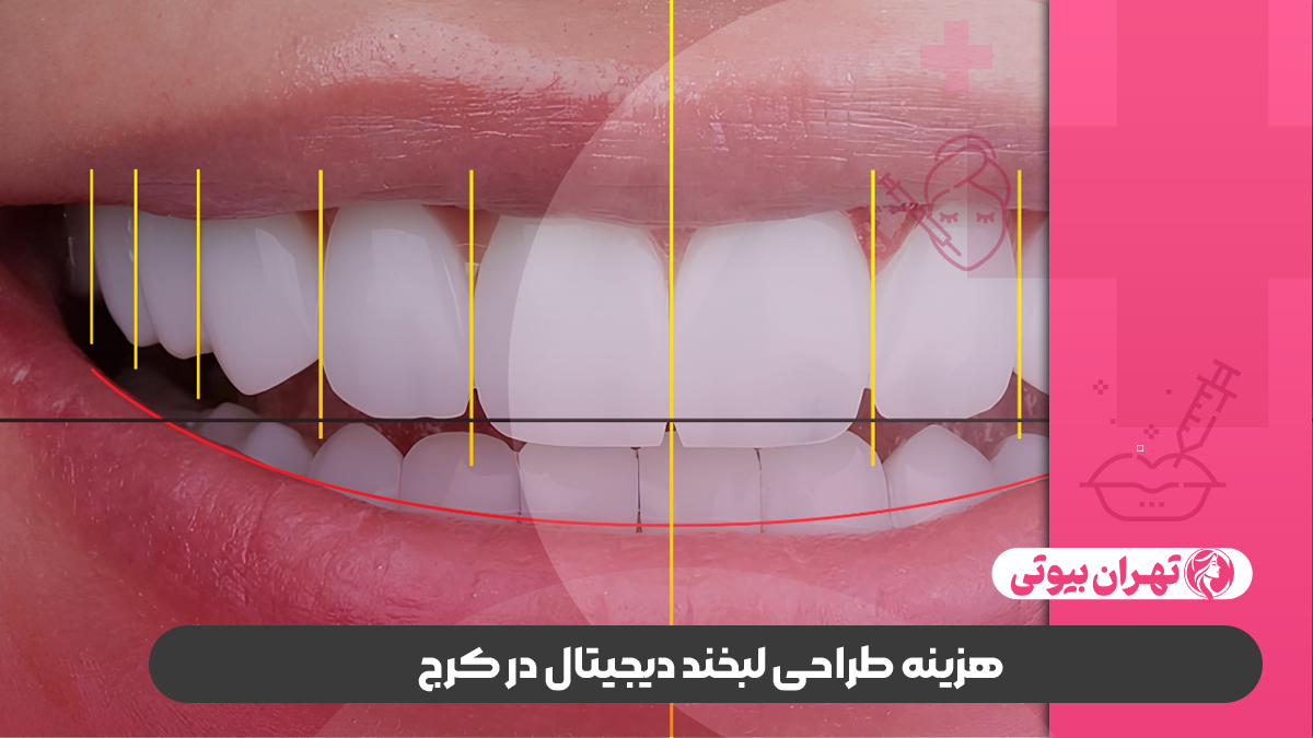 10 بهترین دکتر طراحی لبخند دیجیتال در کرج