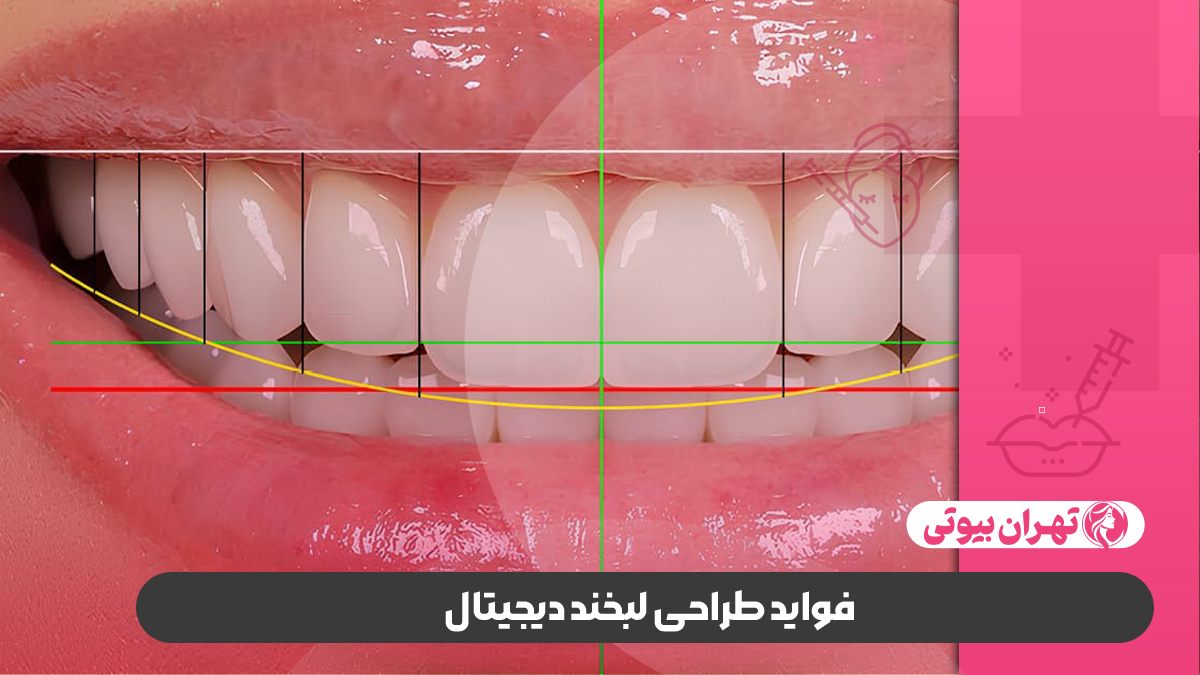 10 بهترین دکتر طراحی لبخند دیجیتال در کرج