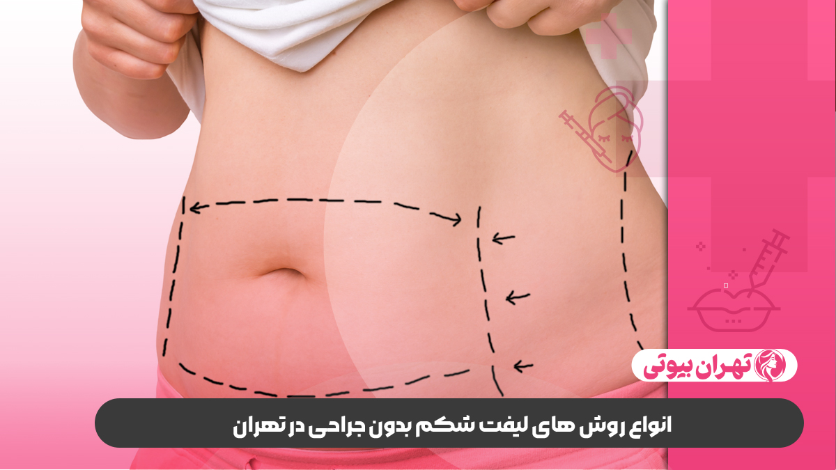 10 بهترین دکتر لیفت شکم بدون جراحی در تهران