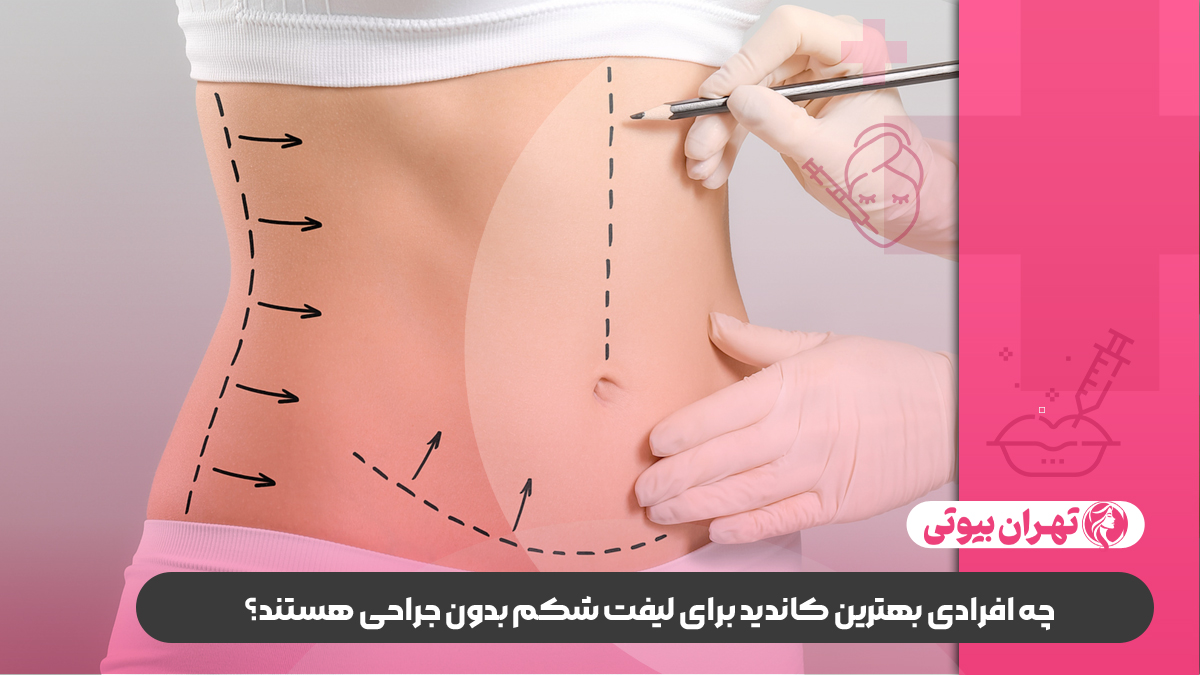 10 بهترین دکتر لیفت شکم بدون جراحی در تهران