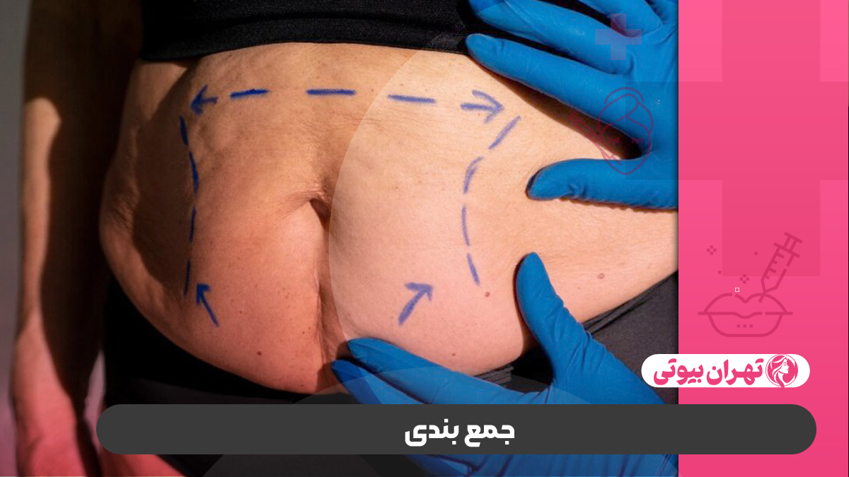 10 بهترین دکتر لیفت شکم بدون جراحی در تهران