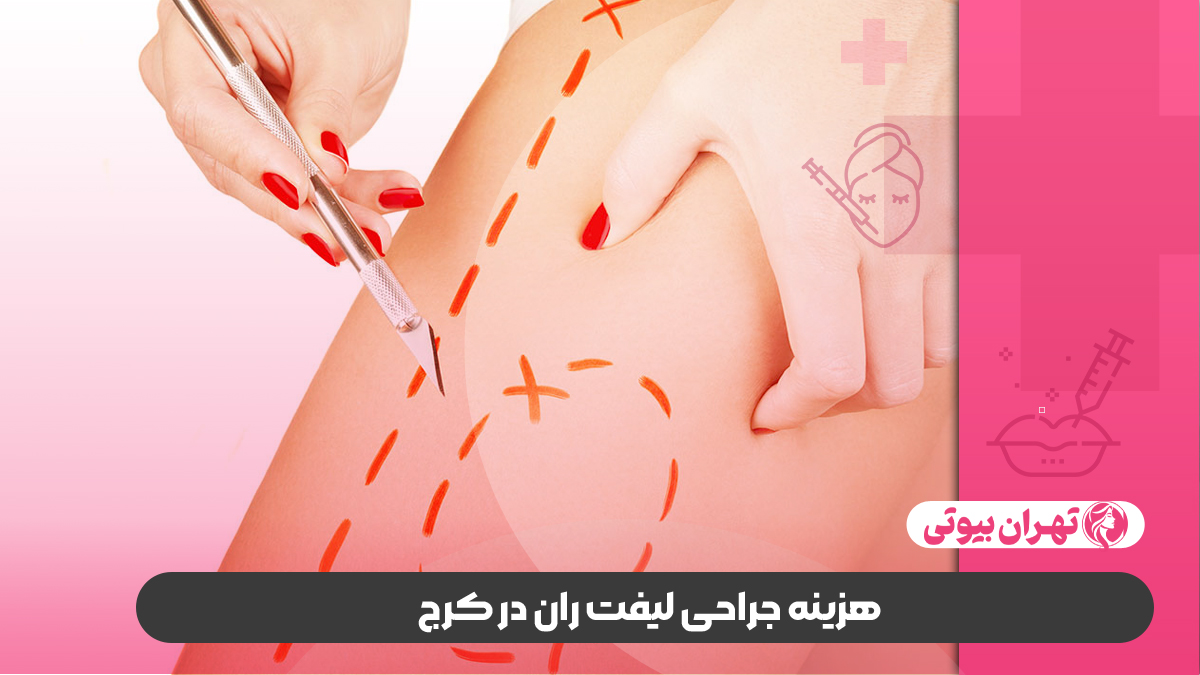 10 بهترین دکتر جراح لیفت ران در کرج