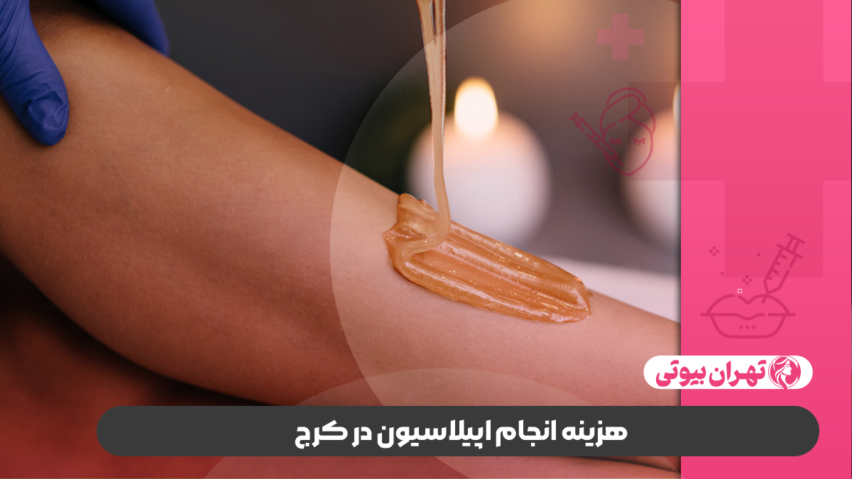 10 بهترین مرکز اپیلاسیون در کرج
