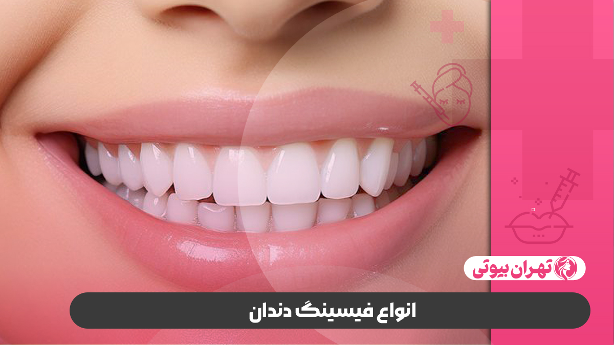 10 بهترین دکتر فیسینگ دندان در تهران