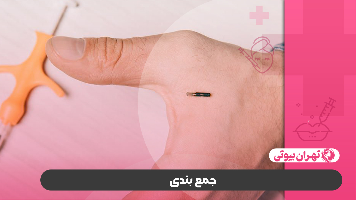 10 بهترین دکتر امبدینگ و لاغری با کاشت نخ در تهران