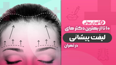 10 بهترین دکتر لیفت پیشانی در تهران