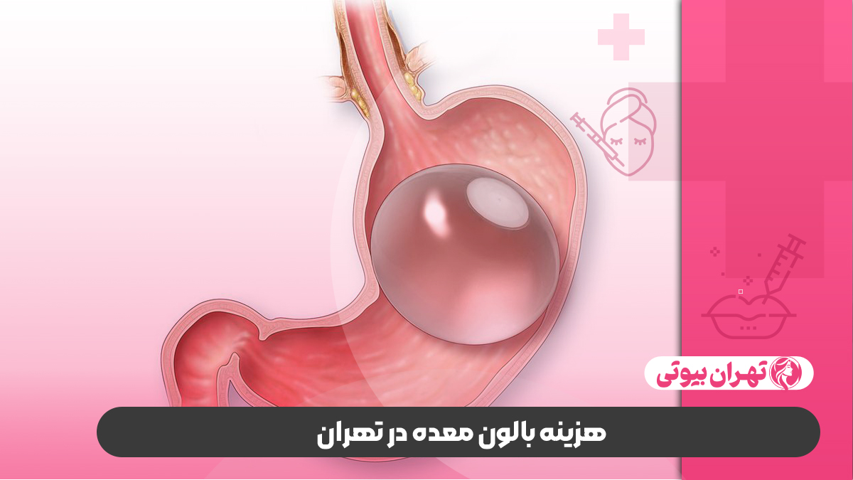 10 بهترین دکتر بالون معده در تهران