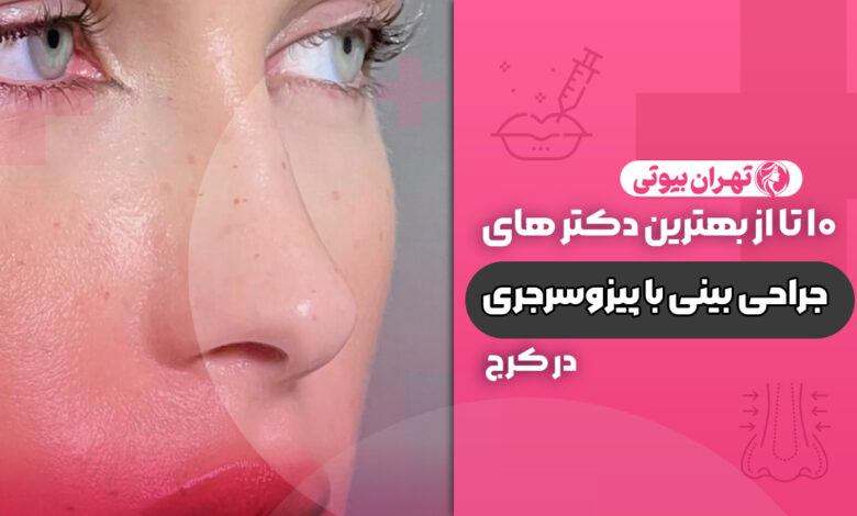 10 بهترین دکتر جراحی بینی با پیزوسرجری در کرج