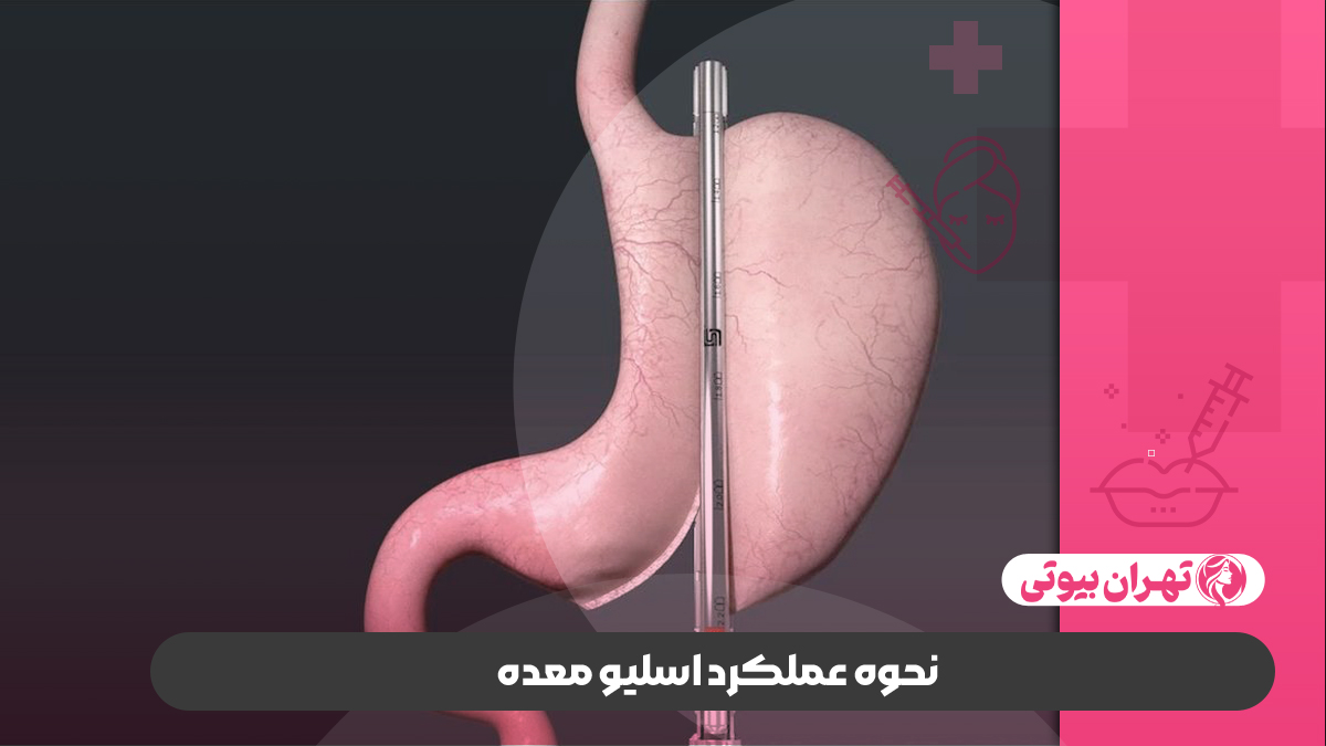 10 بهترین دکتر اسلیو معده در تهران