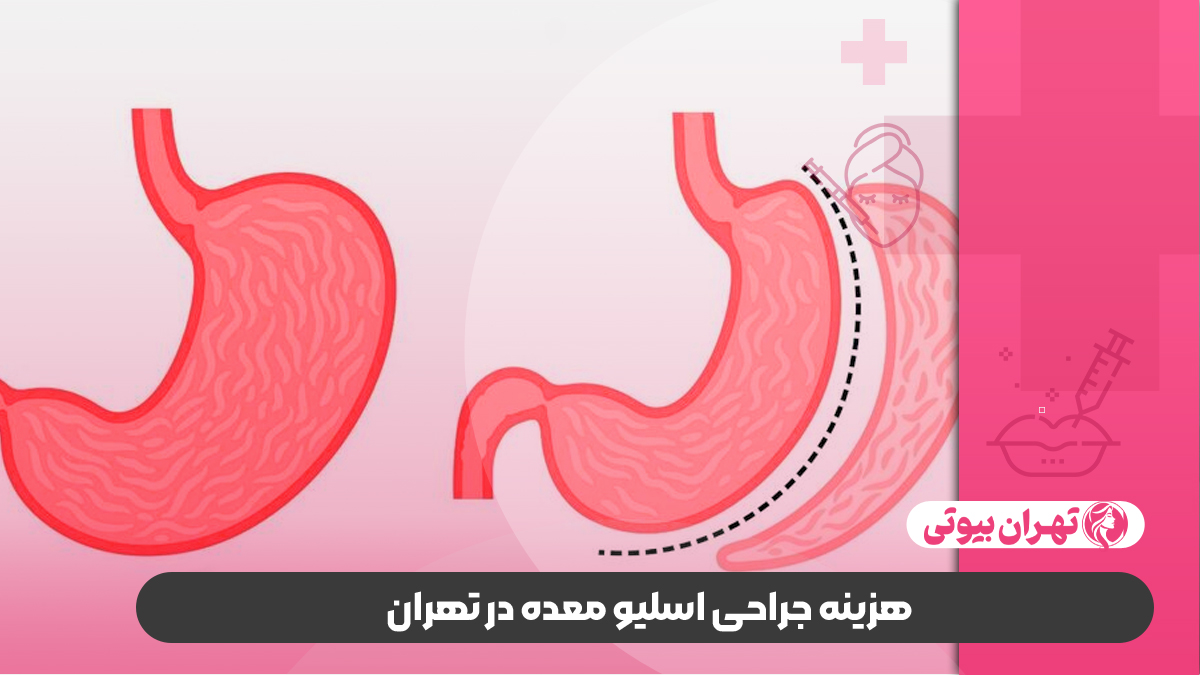 10 بهترین دکتر اسلیو معده در تهران