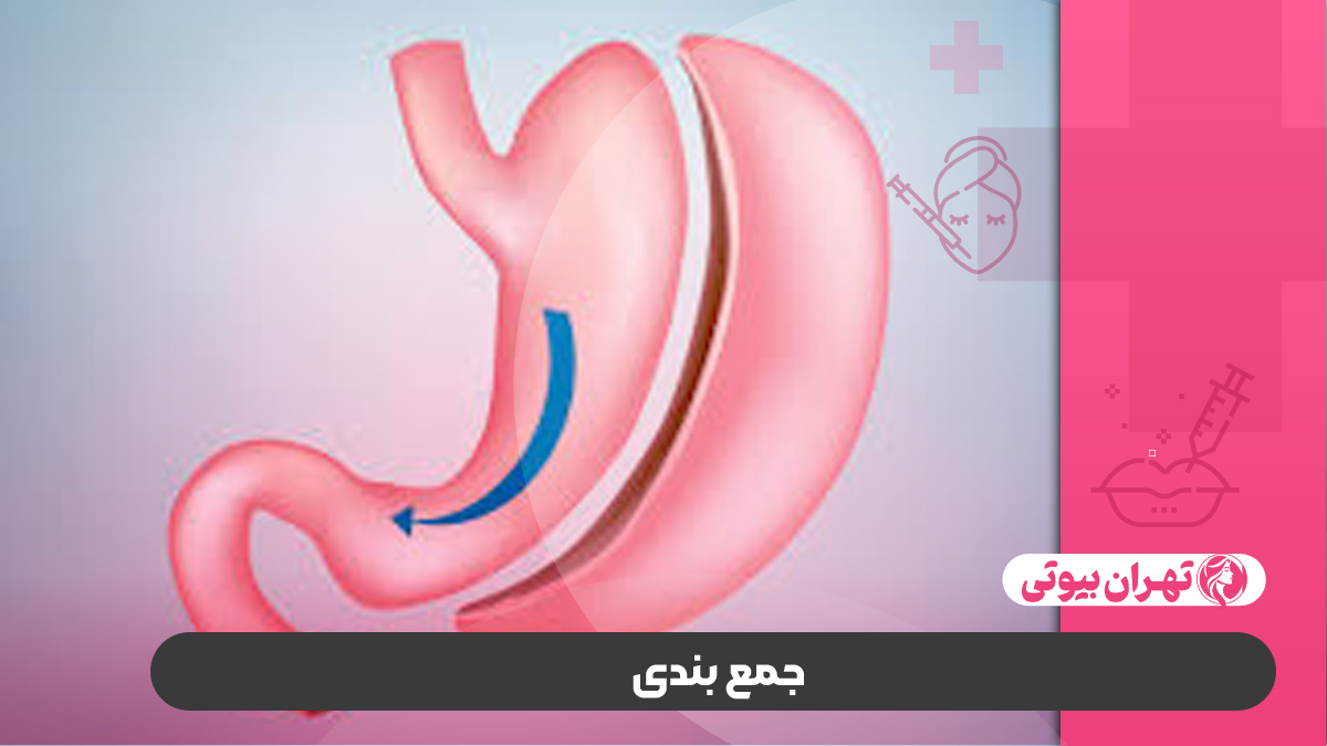 10 بهترین دکتر اسلیو معده در تهران