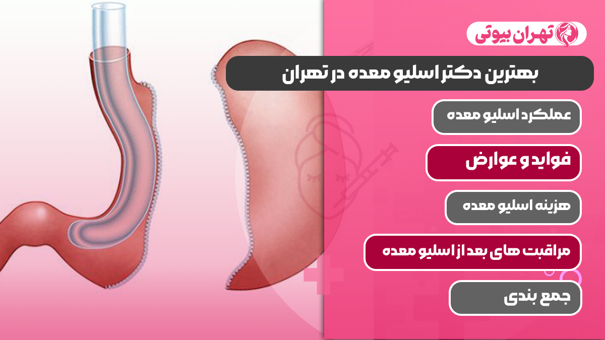 10 بهترین دکتر اسلیو معده در تهران