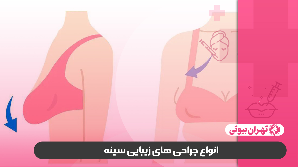 10 بهترین دکتر جراح زیبایی سینه در کرج
