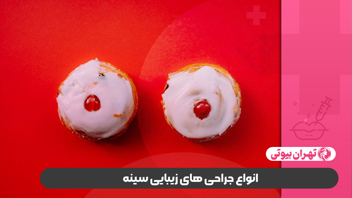 10 بهترین دکتر جراح زیبایی سینه در تهران