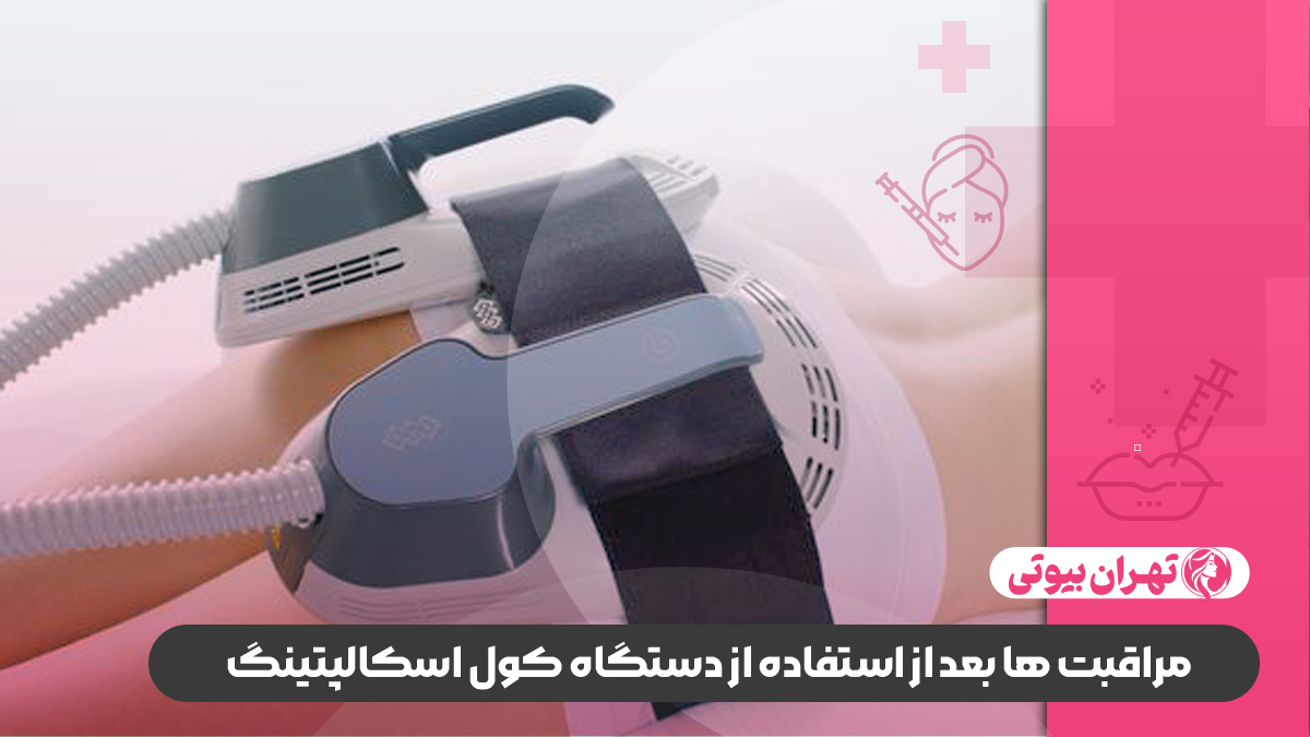 10 بهترین مرکز لاغری با کول اسکالپتینگ در تهران