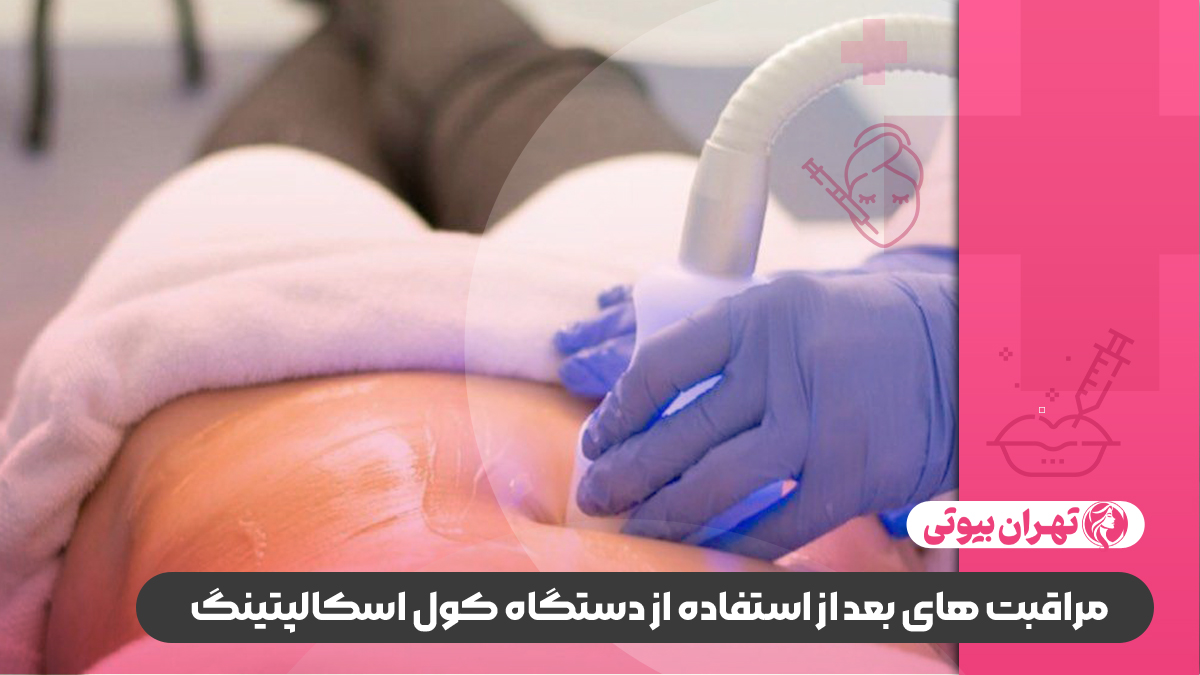 10 بهترین مرکز لاغری با کول اسکالپتینگ در کرج