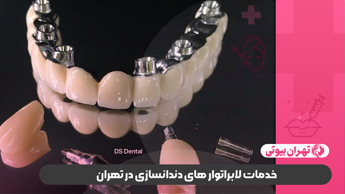 10 بهترین لابراتوار دندانسازی در تهران