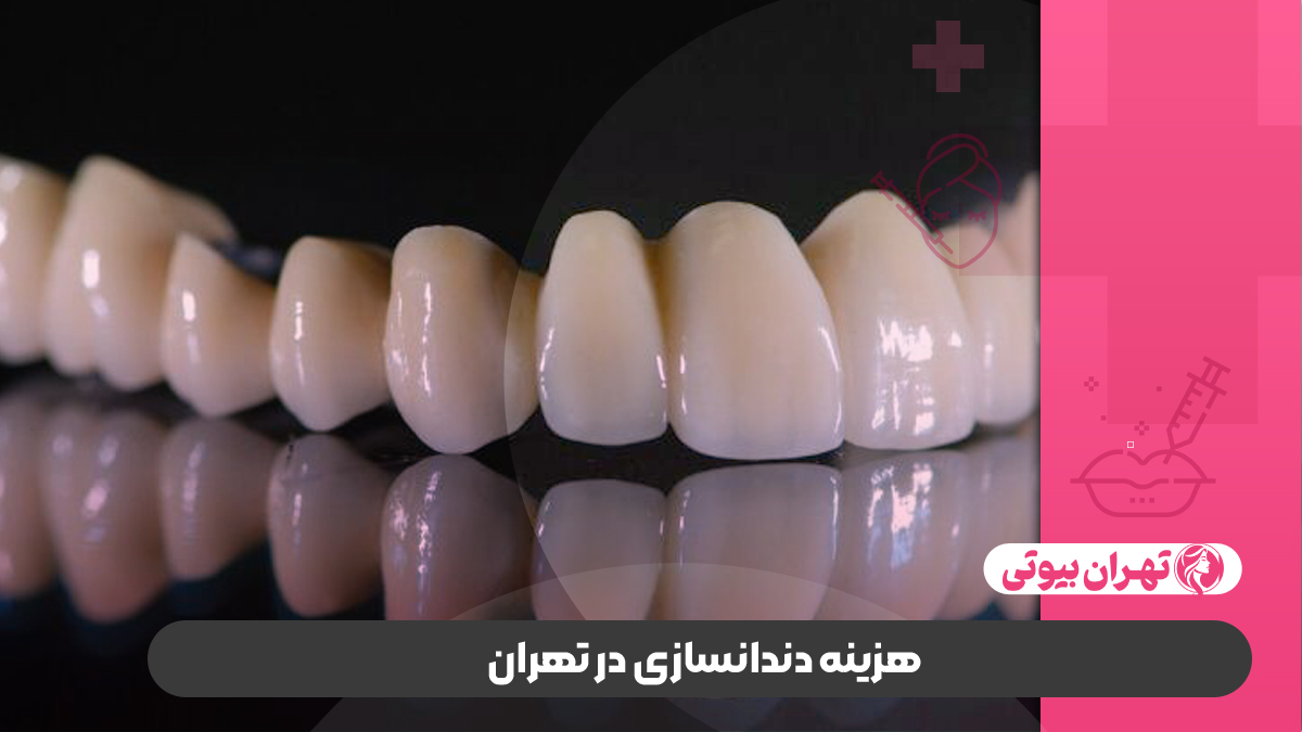 10 بهترین لابراتوار دندانسازی در تهران