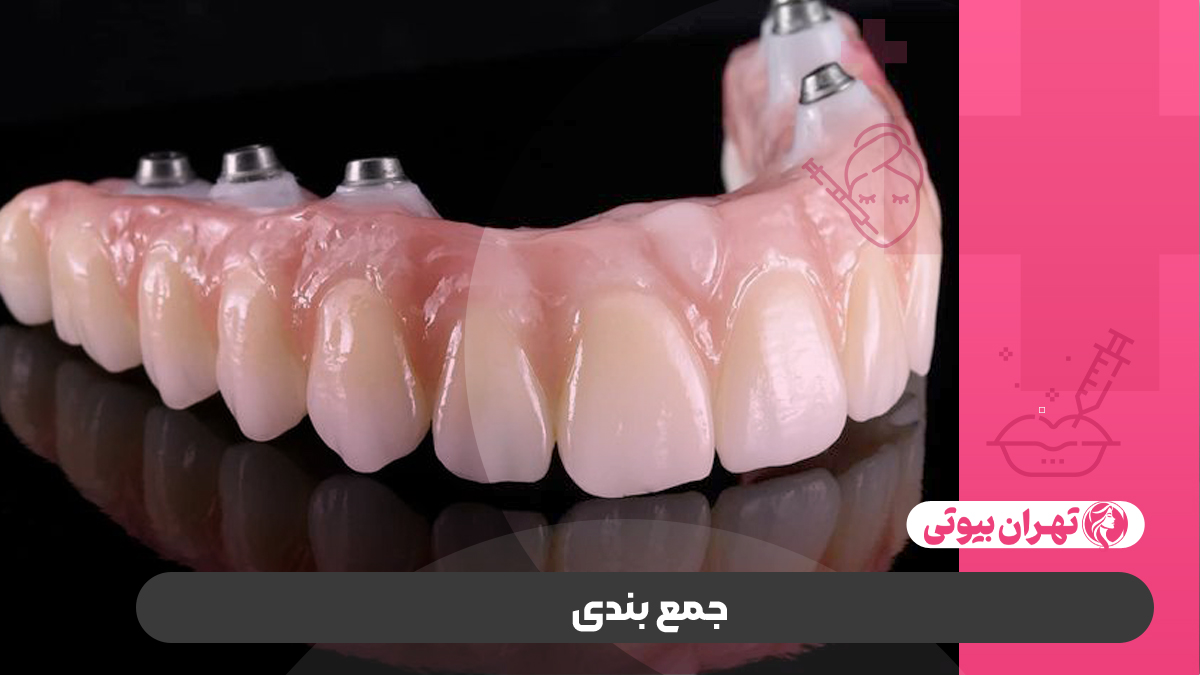 10 بهترین لابراتوار دندانسازی در تهران