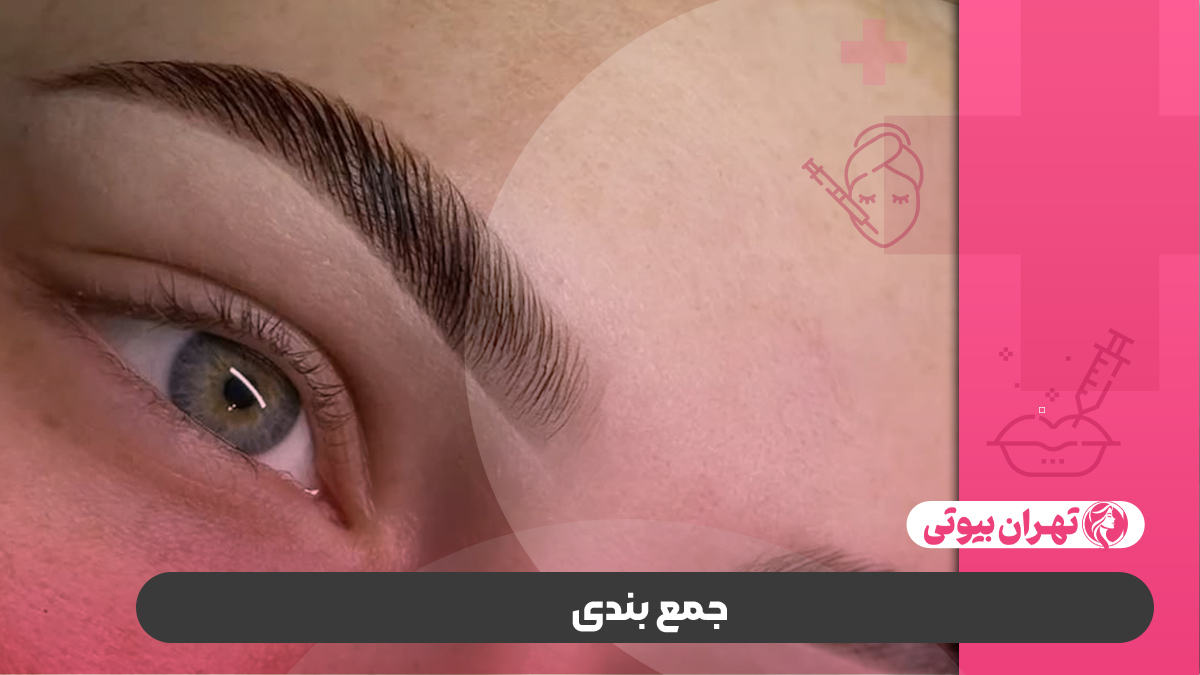 10 بهترین مرکز فیبروز ابرو در کرج