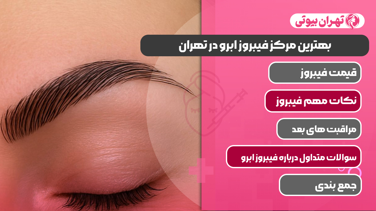 10 بهترین مرکز فیبروز ابرو در تهران