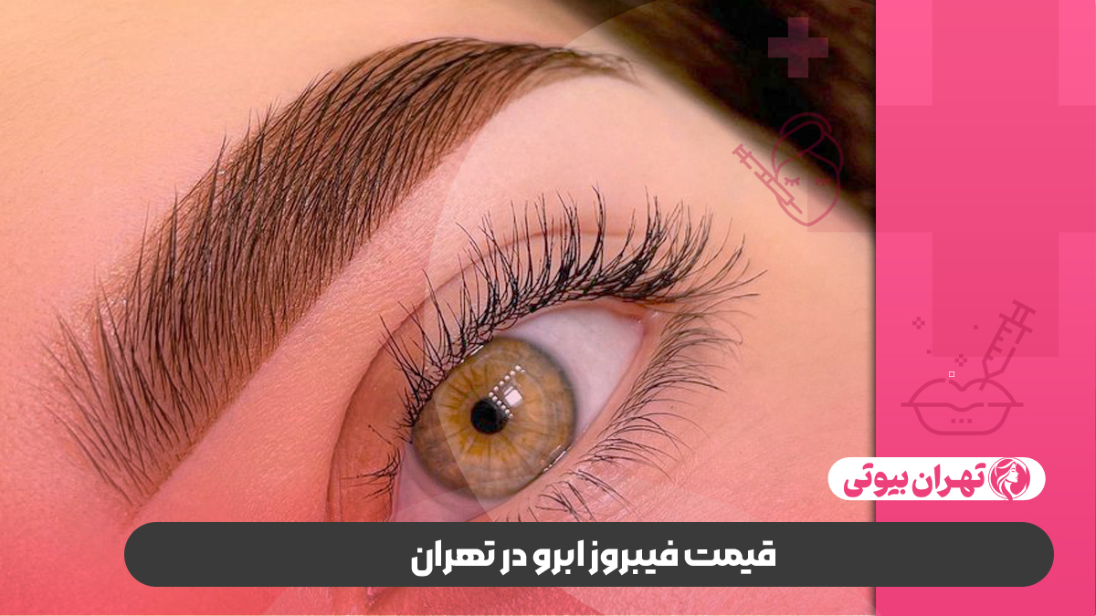 10 بهترین مرکز فیبروز ابرو در تهران