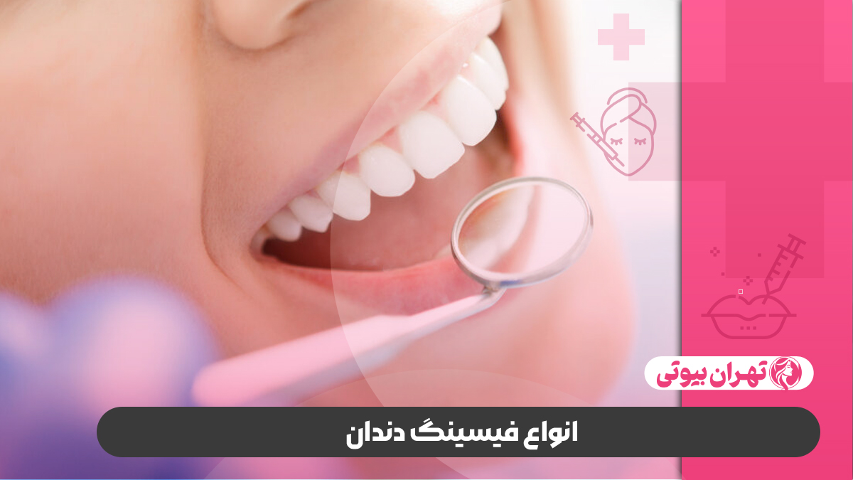 10 بهترین دکتر فیسینگ دندان در کرج