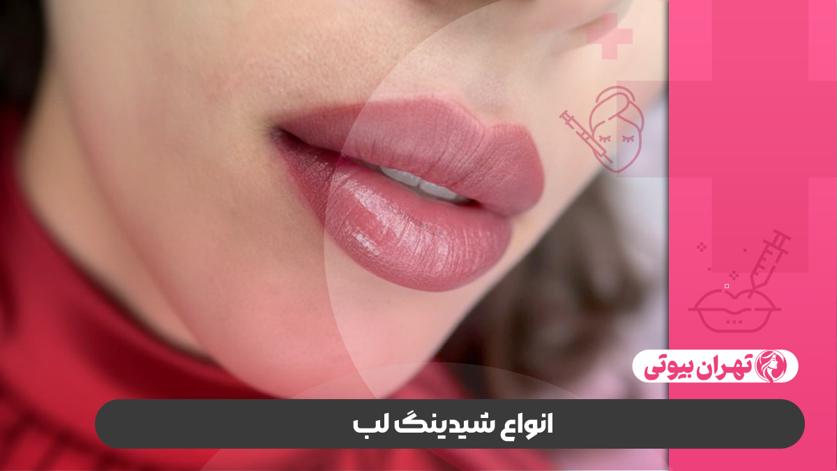 10 بهترین مرکز شیدینگ لب در کرج