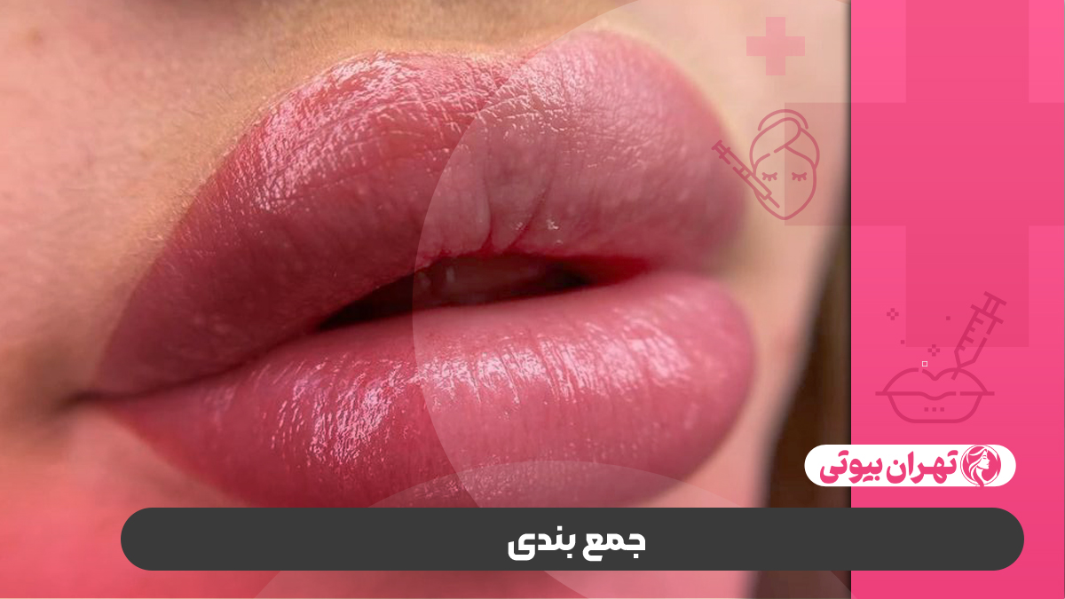 10 بهترین مرکز شیدینگ لب در کرج