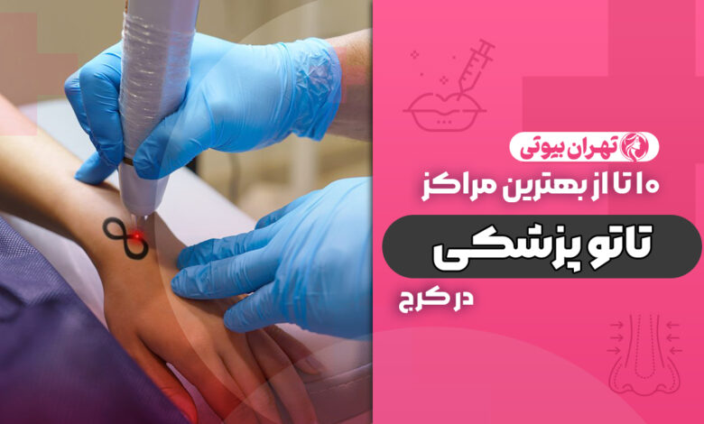 10 بهترین مرکز تاتو پزشکی در کرج