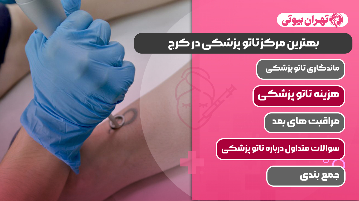 10 بهترین مرکز تاتو پزشکی در کرج