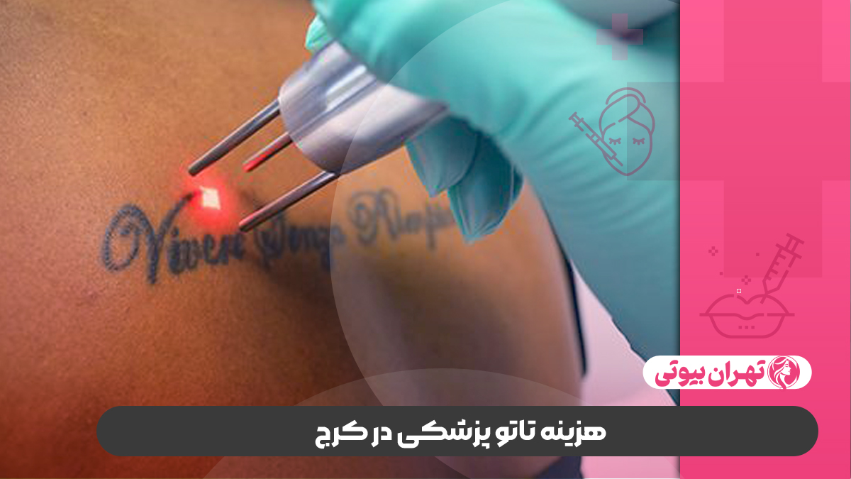 10 بهترین مرکز تاتو پزشکی در کرج