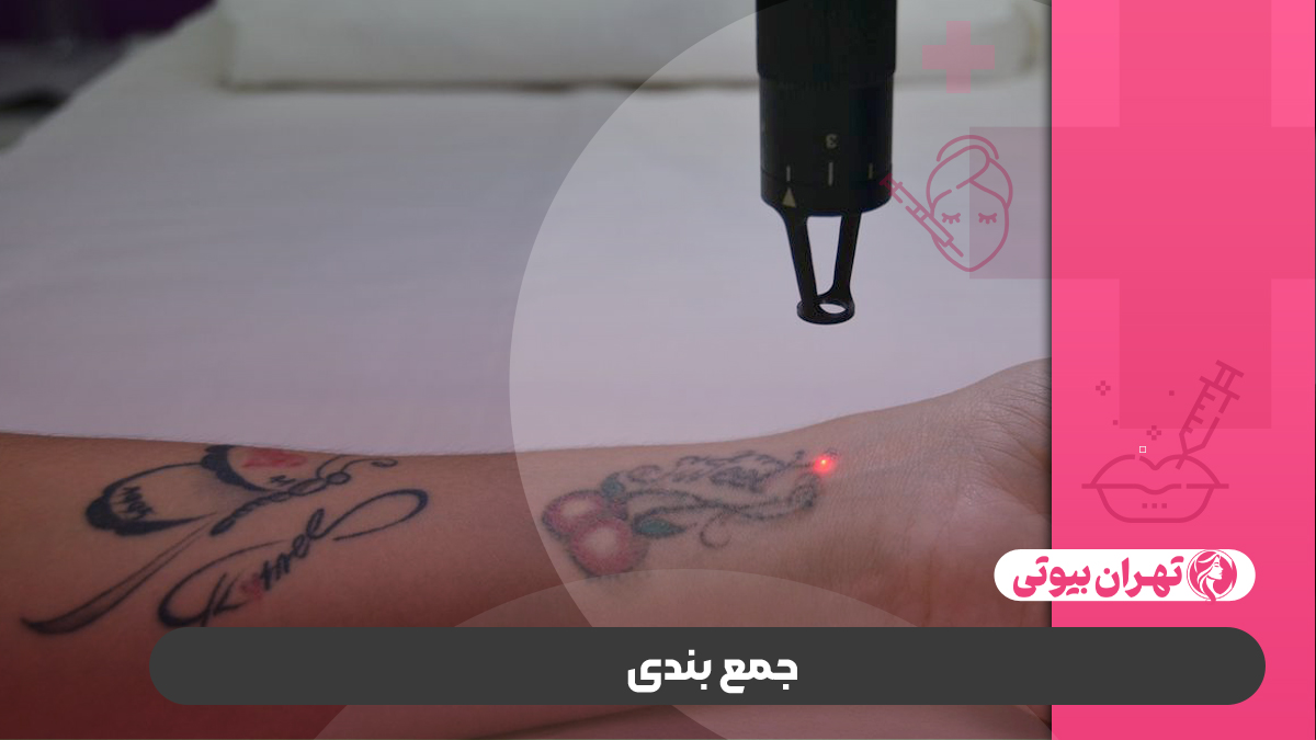 10 بهترین مرکز تاتو پزشکی در کرج