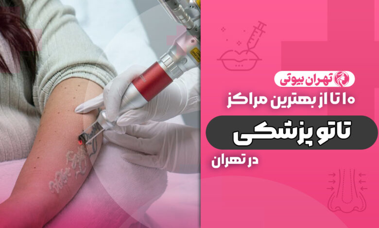 10 بهترین مرکز تاتو پزشکی در تهران