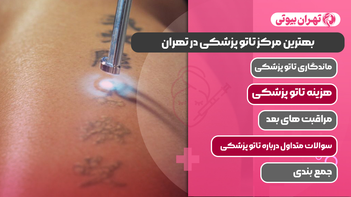 10 بهترین مرکز تاتو پزشکی در تهران