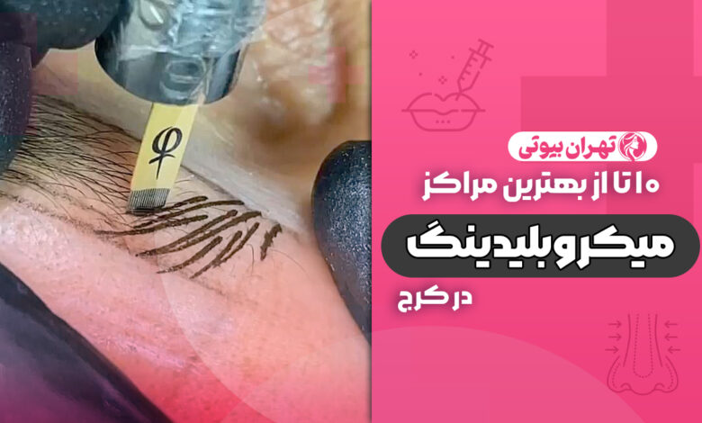 10 تا از بهترین مرکز میکروبلیدینگ در کرج